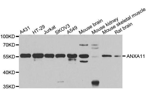 Annexin A11 Antikörper  (AA 276-505)