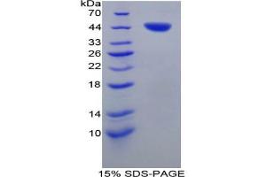 SDS-PAGE analysis of Pig Tryptase Protein. (TPSAB1 Protein)