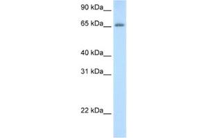 Western Blotting (WB) image for anti-Adenosine Deaminase, tRNA-Specific 1 (ADAT1) antibody (ABIN2462241) (ADAT1 Antikörper)