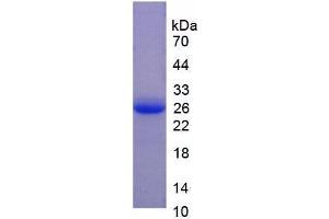 SDS-PAGE (SDS) image for Coagulation Factor V (F5) (AA 1941-2095) protein (His tag) (ABIN1079221) (Coagulation Factor V Protein (F5) (AA 1941-2095) (His tag))