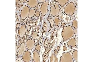 IHC analysis of SNRPD2 using anti-SNRPD2 antibody (ABIN7598963).