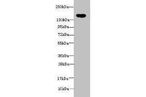 Western blot All lanes: ADAMTS7 antibody at 2 μg/mL + Mouse brain tissue Secondary Goat polyclonal to rabbit IgG at 1/10000 dilution Predicted band size: 184 kDa Observed band size: 184 kDa (ADAMTS7 Antikörper  (AA 242-593))