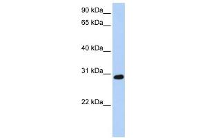 WB Suggested Anti-XBP1 Antibody Titration: 0. (XBP1 Antikörper  (C-Term))