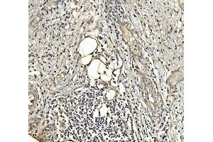 IHC analysis of Aldolase/ALDOA using anti-Aldolase/ALDOA antibody (ABIN7601908). (ALDOA Antikörper  (AA 50-364))