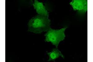 Anti-TKT mouse monoclonal antibody (ABIN2453725) immunofluorescent staining of COS7 cells transiently transfected by pCMV6-ENTRY TKT (RC203497).