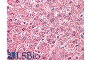 ABIN571255 (5µg/ml) staining of paraffin embedded Human Liver. (ALDH6A1 Antikörper  (AA 262-272))