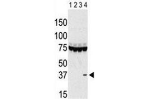 Western blot testing of Aurora-C antibody and lysate of 293 cells expressing 1) Flag tag, 2) Flag-tagged -A, 3) -B and 4) Aurora-C. (Aurora Kinase C Antikörper  (AA 115-145))