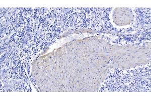 Detection of ELN in Human Spleen Tissue using Polyclonal Antibody to Elastin (ELN) (Elastin Antikörper  (AA 392-645))