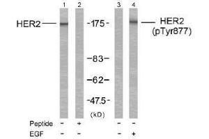Image no. 2 for anti-Receptor tyrosine-protein kinase erbB-2 (ErbB2/Her2) (Tyr877) antibody (ABIN197223) (ErbB2/Her2 Antikörper  (Tyr877))