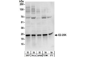 Western Blotting (WB) image for anti-Ubiquitin-Conjugating Enzyme E2K (UBE2K) (AA 150-200) antibody (ABIN7449722)