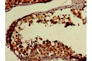 Immunohistochemistry of paraffin-embedded human testis tissue using ABIN7152652 at dilution of 1:100 (FAAH Antikörper  (AA 205-342))