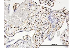 Image no. 1 for anti-Runt-Related Transcription Factor 2 (RUNX2) (AA 251-351) antibody (ABIN599359) (RUNX2 Antikörper  (AA 251-351))