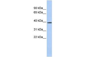 WB Suggested Anti-CLN6 Antibody Titration:  0. (CLN6 Antikörper  (Middle Region))