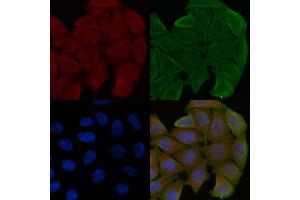 ABIN6259458 and ABIN6275227 staining Hela cells(30 min of UV treatment) by IF/ICC. (MBTPS1 Antikörper  (Internal Region))