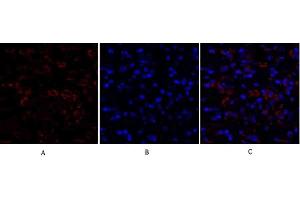 Immunofluorescence analysis of human breast cancer tissue. (Ki-67 Antikörper  (AA 3170-3250))