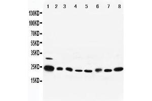 Lane 8: MM453 Cell Lysate (RAB5 Antikörper  (Middle Region))