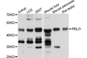 Western blot analysis of extracts of various cell lines, using PELO antibody (ABIN5972746) at 1/1000 dilution. (PELO Antikörper)