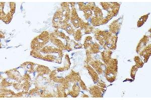 Immunohistochemistry of paraffin-embedded Rat heart using TRAP1 Polyclonal Antibody at dilution of 1:100 (40x lens). (TRAP1 Antikörper)
