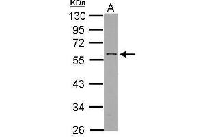 WB Image Sample (30 ug of whole cell lysate) A: HepG2 10% SDS PAGE antibody diluted at 1:1000 (ANGPTL3 Antikörper)
