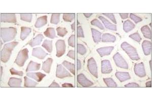 Immunohistochemistry analysis of paraffin-embedded human skeletal muscle, using TNNI3 (Phospho-Ser22+Ser23) Antibody.