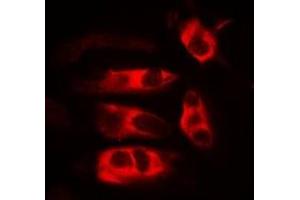Immunofluorescent analysis of HFE staining in MCF7 cells. (HFE Antikörper)