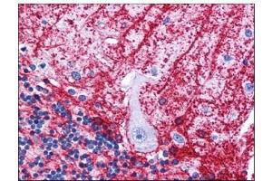 Human Brain, Cerebellum: Formalin-Fixed, Paraffin-Embedded (FFPE) (SIPA1L3 Antikörper  (N-Term))