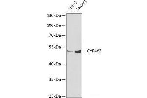 Western blot analysis of extracts of various cell lines using CYP4V2 Polyclonal Antibody at dilution of 1:1000. (CYP4V2 Antikörper)