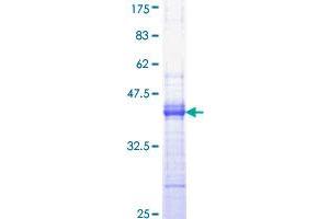 Image no. 1 for Epidermal Growth Factor (EGF) (AA 926-1025) protein (GST tag) (ABIN1352425)