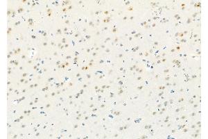 ABIN6257927 and ABIN6274304 at 1/100 staining Rat brain tissue by IHC-P. (RED1 Antikörper  (Internal Region))