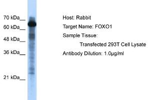 WB Suggested Anti-FOXO1 Antibody   Titration: 1. (FOXO1 Antikörper  (C-Term))
