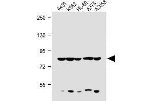 All lanes : Anti-ABCB5 Antibody (N-term) at 1:1000 dilution Lane 1: A431 whole cell lysate Lane 2: K562 whole cell lysate Lane 3: HL-60 whole cell lysate Lane 4:  whole cell lysate Lane 5:  whole cell lysate Lysates/proteins at 20 μg per lane. (ABCB5 Antikörper  (N-Term))