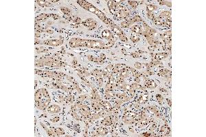 IHC analysis of SNRNP40 using anti-SNRNP40 antibody (ABIN7601719). (SNRNP40 Antikörper  (AA 43-357))
