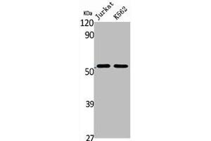 Western Blot analysis of Jurkat K562 cells using BAGE5 Polyclonal Antibody (BAG5 Antikörper  (N-Term))