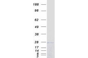 Validation with Western Blot (SOCS1 Protein (Myc-DYKDDDDK Tag))