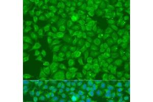 Immunofluorescence analysis of U2OS cells using SLC25A6 Polyclonal Antibody at dilution of 1:100. (SLC25A6 Antikörper)