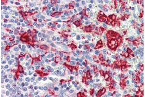 Human Spleen (formalin-fixed, paraffin-embedded) stained with HMOX1 antibody ABIN462108 at 10 ug/ml followed by biotinylated goat anti-rabbit IgG secondary antibody ABIN481713, alkaline phosphatase-streptavidin and chromogen. (HMOX1 Antikörper)