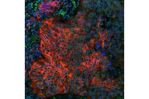 Immunofluorescence (IF) image for anti-CD274 (PD-L1) (C-Term) antibody (ABIN7454042) (Rekombinanter PD-L1 Antikörper  (C-Term))
