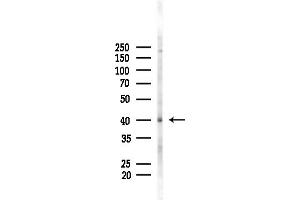 Western blot analysis of lysates from F10-LUC cells(LPS, 4h treatment), using EIF2 Antibody at 1/1000 dilution.