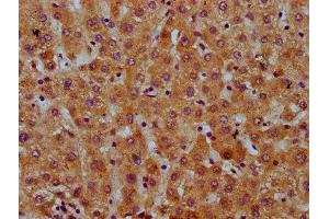 IHC image of ABIN7169368 diluted at 1:600 and staining in paraffin-embedded human liver tissue performed on a Leica BondTM system. (SAA2 Antikörper  (AA 19-94))