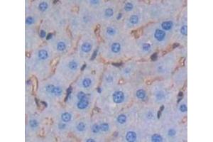 IHC-P analysis of Mouse Tissue, with DAB staining. (Lymphocyte Function Associated Antigen 2 (AA 23-203) Antikörper)