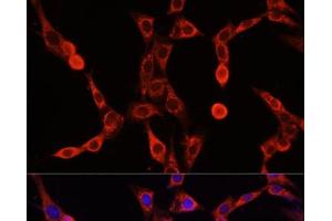 Immunofluorescence analysis of NIH/3T3 cells using ABCD1 Polyclonal Antibody at dilution of 1:100. (ABCD1 Antikörper)