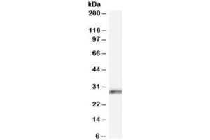Western blot testing of HeLa cell lysate with HOXB13 antibody at 0. (HOXB13 Antikörper)