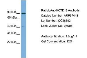 WB Suggested Anti-KCTD16  Antibody Titration: 0. (KCTD16 Antikörper  (N-Term))