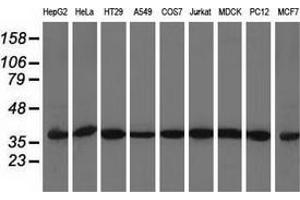 Western blot analysis of extracts (35 µg) from 9 different cell lines by using anti-ACAT2 monoclonal antibody. (ACAT2 Antikörper)