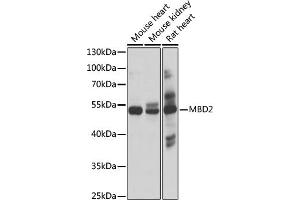 Western blot analysis of extracts of various cell lines, using MBD2 antibody (ABIN1680781, ABIN3015876, ABIN3015877 and ABIN6219461) at 1:1000 dilution. (MBD2 Antikörper  (AA 202-411))