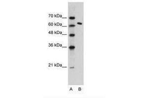 Image no. 1 for anti-FACT complex subunit SPT16 (SUPT16H) (AA 77-126) antibody (ABIN203368) (SUPT16H Antikörper  (AA 77-126))