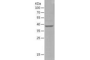 Western Blotting (WB) image for Transcription Factor EB (TFEB) (AA 43-200) protein (His-IF2DI Tag) (ABIN7125448) (TFEB Protein (AA 43-200) (His-IF2DI Tag))