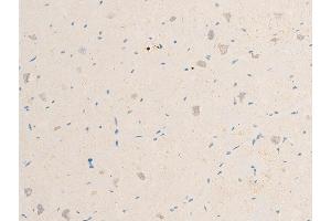 Immunohistochemistry (IHC) image for anti-Spleen tyrosine Kinase (SYK) (pTyr323) antibody (ABIN6256708)