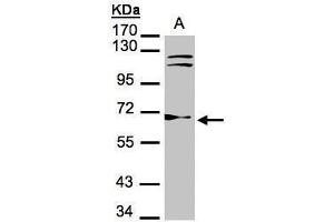 WB Image Sample(30 μg of whole cell lysate) A:Hep G2, 7. (TXNRD1 Antikörper)