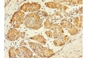 Immunohistochemistry of paraffin-embedded human pancreatic tissue using ABIN7159422 at dilution of 1:100 (MESP1 Antikörper  (AA 149-268))